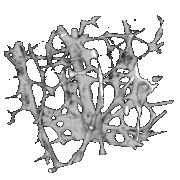 3D microCT image of trabecular bone